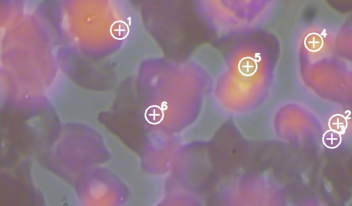 CellVision Blood DSP novelty map — locations to verify
