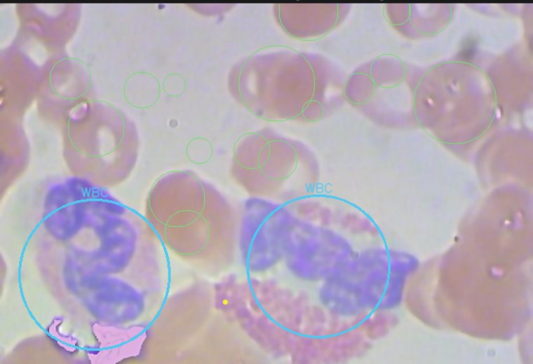 CellVision Blood detection overlay — RBC, WBC and platelets