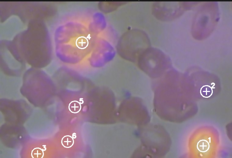 CellVision Blood novelty heatmap with pinpointed cells
